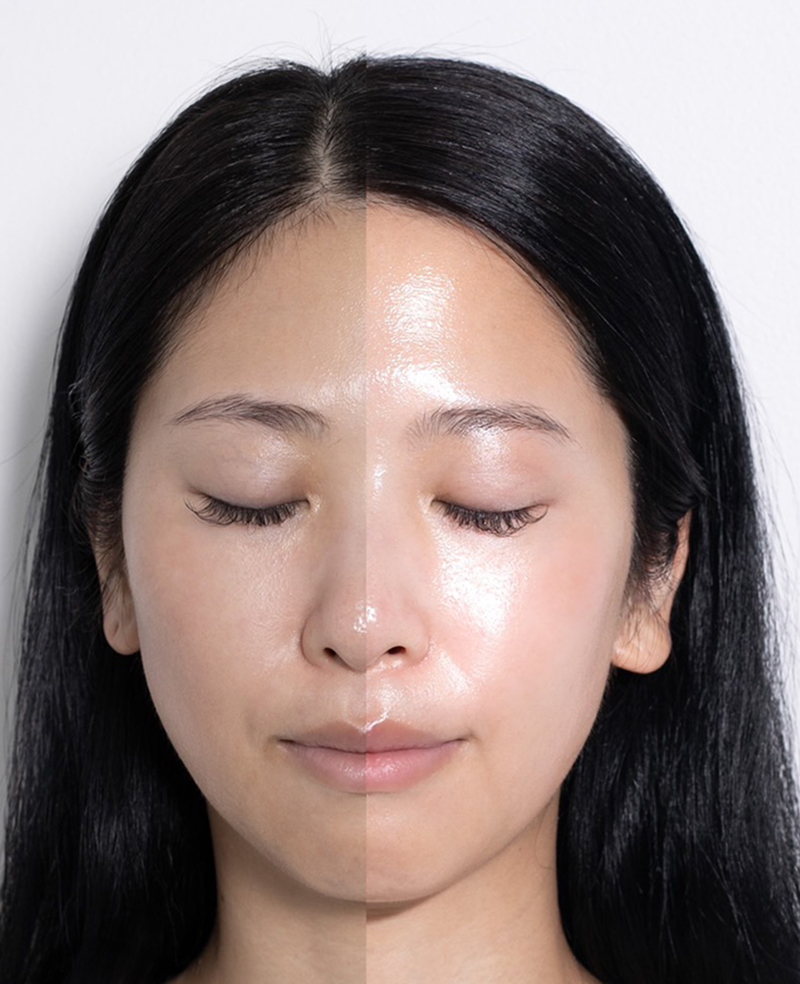 TROIPEEL効果 画像1